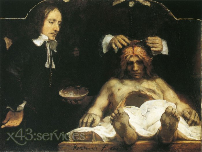 Rembrandt - Anatomie des Doktors Deyman - Anatomy of Doctor Deyman